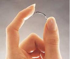 Essure Bayer