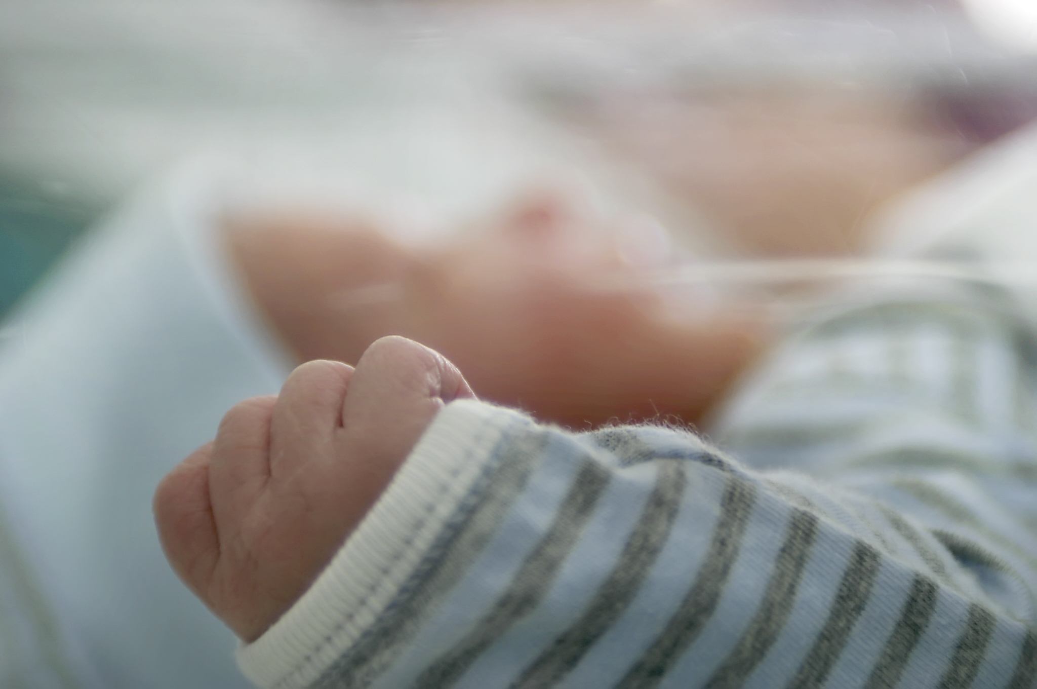 Bebes Sans Bras Dans L Ain Le Remera En Allemagne Apres De Nouveaux Cas